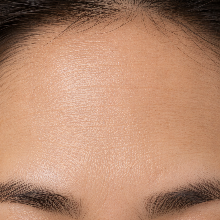 Skin Firming